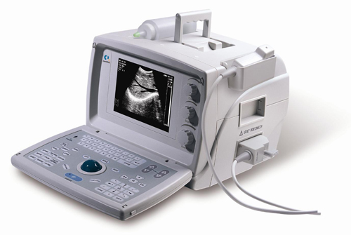 Portable Ultrasound Scanner
