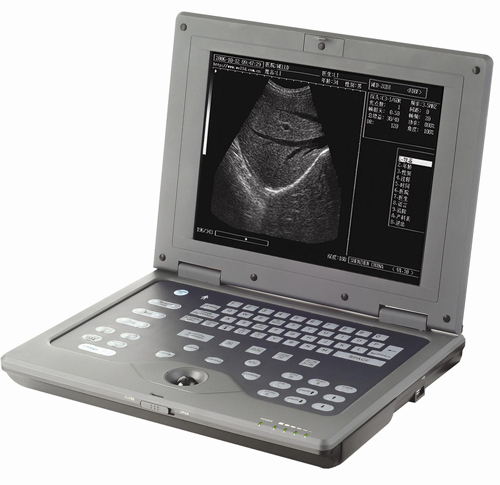 Digital Note Book Ultrasound Scanner CUS-2018